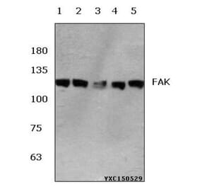 Anti-FAK (E393) Antibody from Bioworld Technology (BS1834) - Antibodies.com