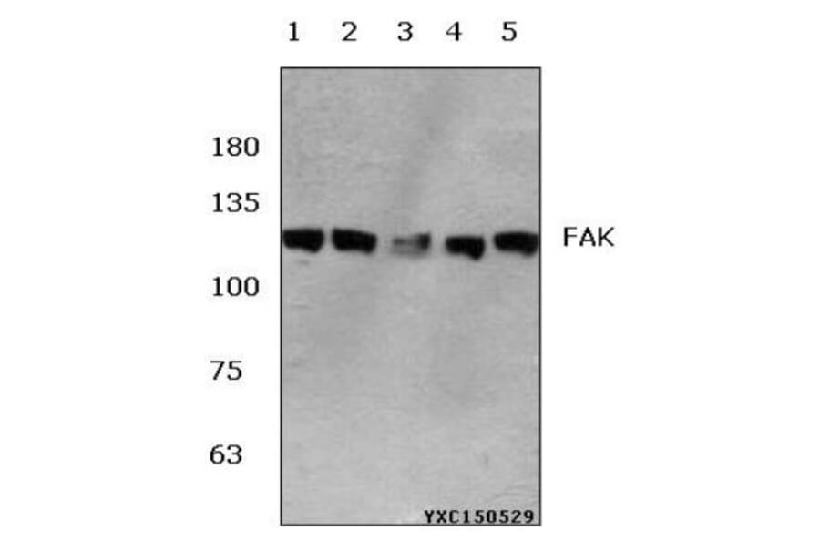 Anti-FAK (E393) Antibody from Bioworld Technology (BS1834) - Antibodies.com