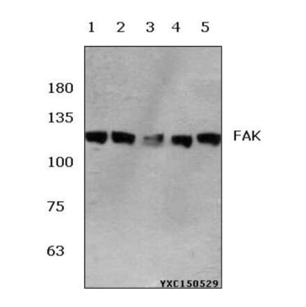 Anti-FAK (E393) Antibody from Bioworld Technology (BS1834) - Antibodies.com