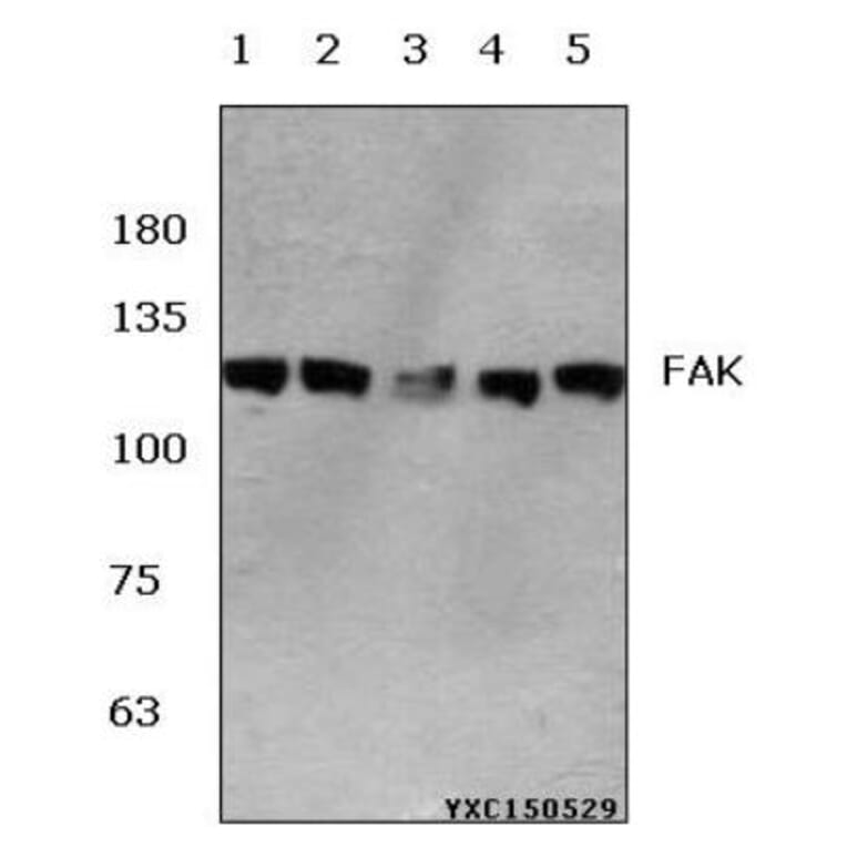 Anti-FAK (E393) Antibody from Bioworld Technology (BS1834) - Antibodies.com