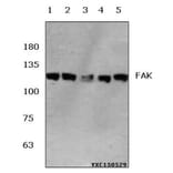 Anti-FAK (E393) Antibody from Bioworld Technology (BS1834) - Antibodies.com