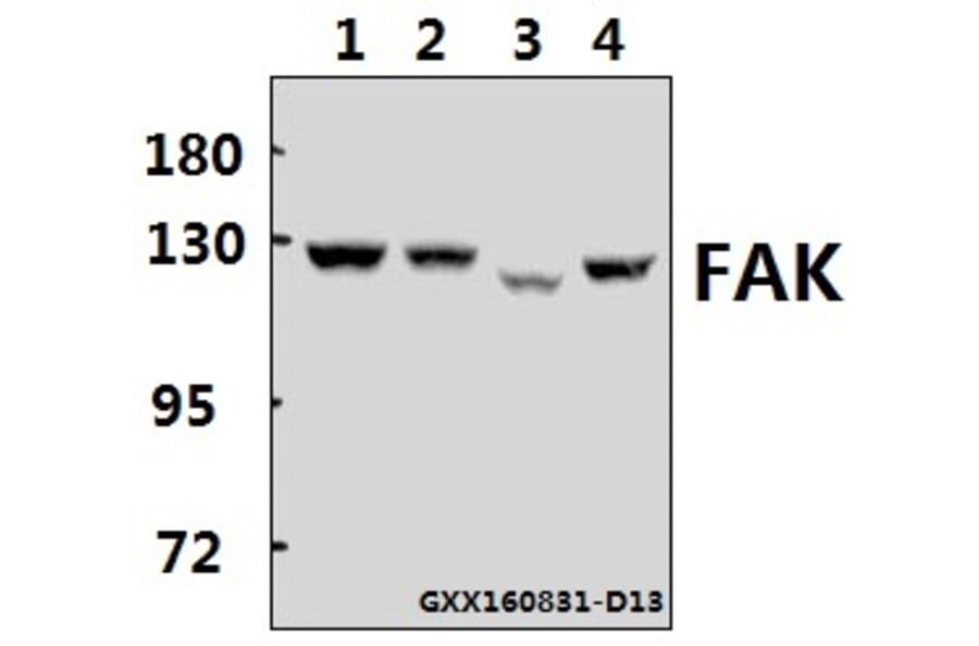 Anti-FAK (E393) Antibody from Bioworld Technology (BS1834) - Antibodies.com