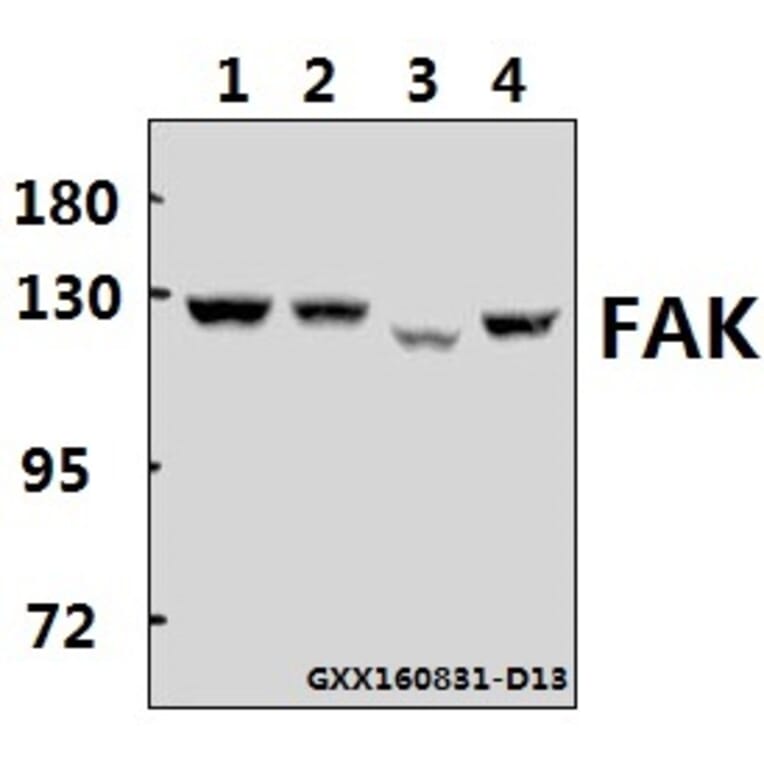Anti-FAK (E393) Antibody from Bioworld Technology (BS1834) - Antibodies.com
