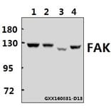 Anti-FAK (E393) Antibody from Bioworld Technology (BS1834) - Antibodies.com