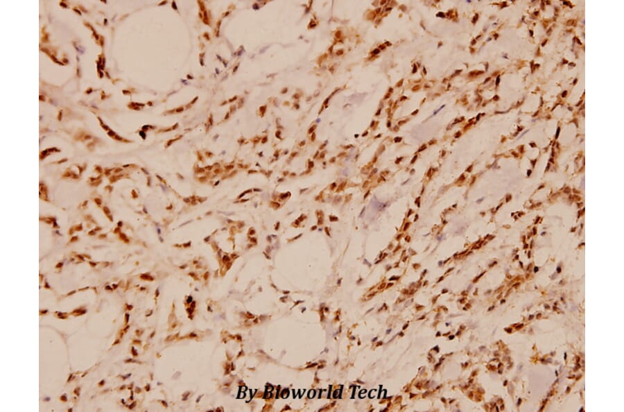 Anti-FAK (E393) Antibody from Bioworld Technology (BS1834) - Antibodies.com