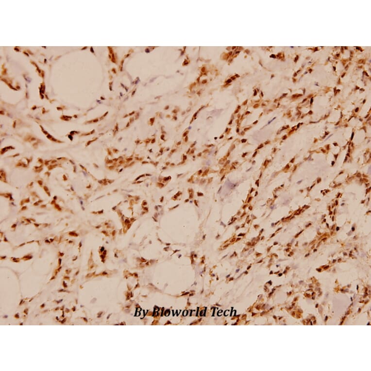 Anti-FAK (E393) Antibody from Bioworld Technology (BS1834) - Antibodies.com