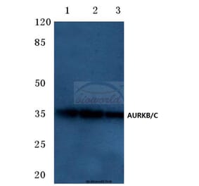 Anti-AURKB/C (K197) Antibody from Bioworld Technology (BS1841) - Antibodies.com