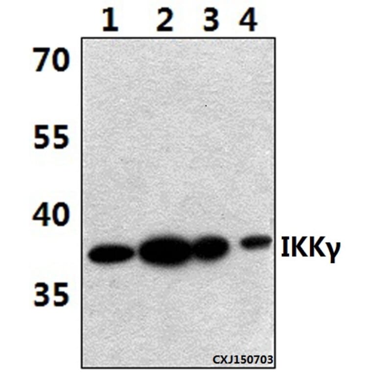 Anti-IKKγ (H81) Antibody from Bioworld Technology (BS1843) - Antibodies.com
