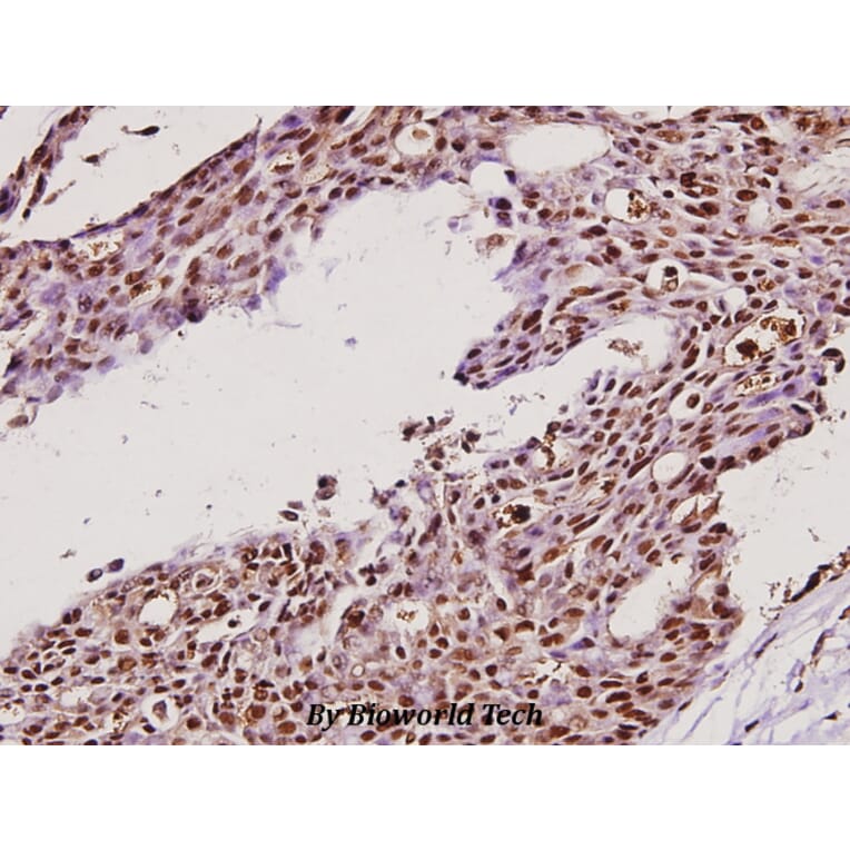 Anti-IKKγ (H81) Antibody from Bioworld Technology (BS1843) - Antibodies.com