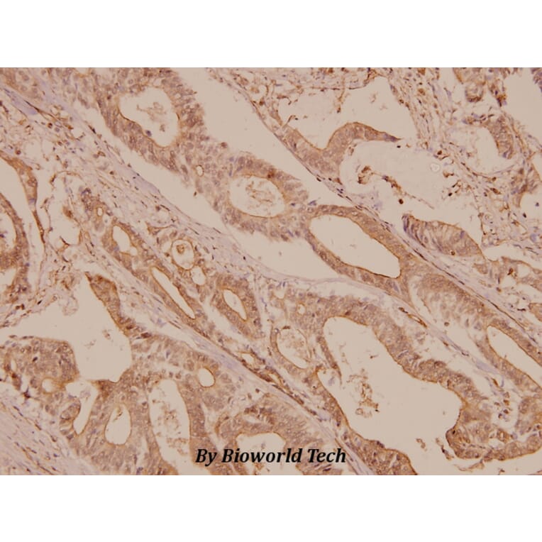 Anti-mTOR (S2442) Antibody from Bioworld Technology (BS1844) - Antibodies.com