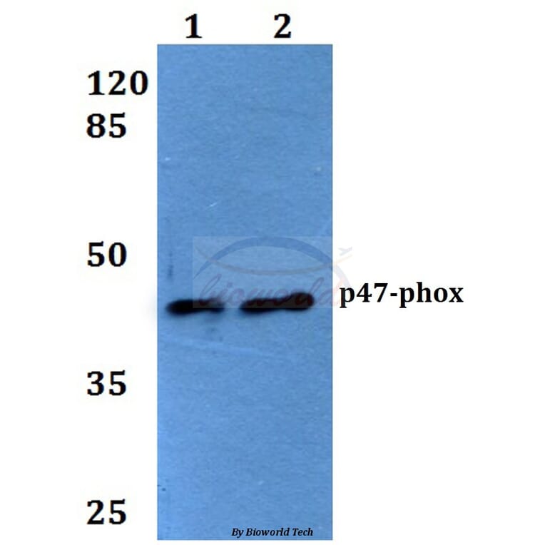 Anti-p47-phox (P300) Antibody from Bioworld Technology (BS1846) - Antibodies.com