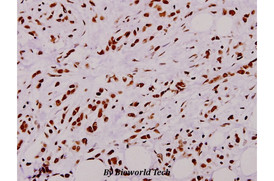 Anti-p47-phox (P300) Antibody from Bioworld Technology (BS1846) - Antibodies.com