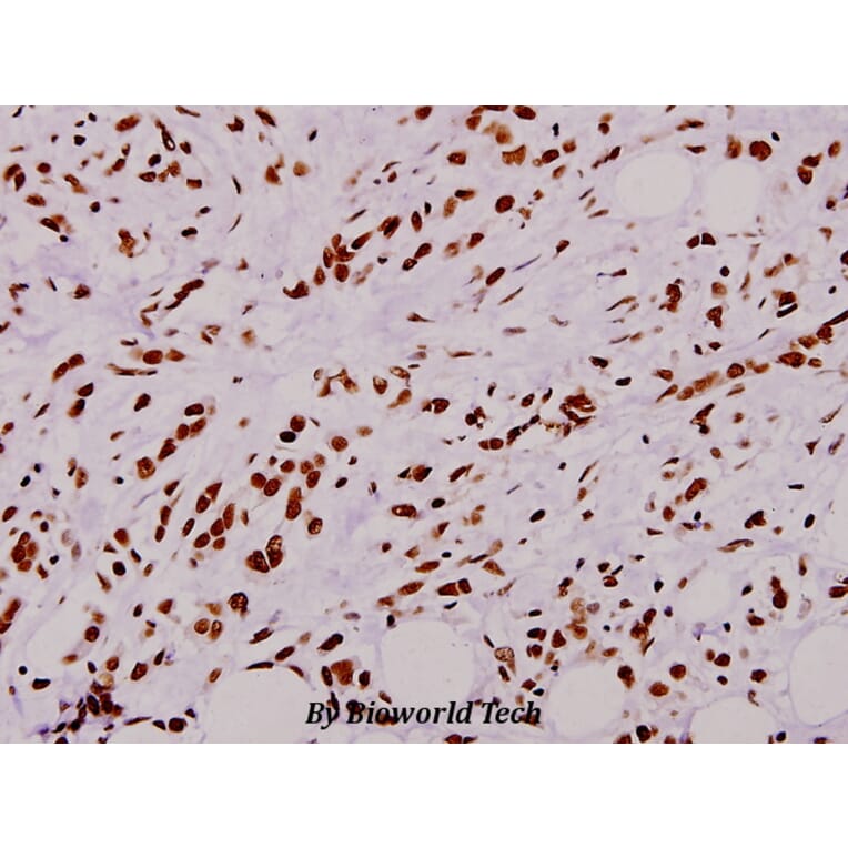Anti-p47-phox (P300) Antibody from Bioworld Technology (BS1846) - Antibodies.com