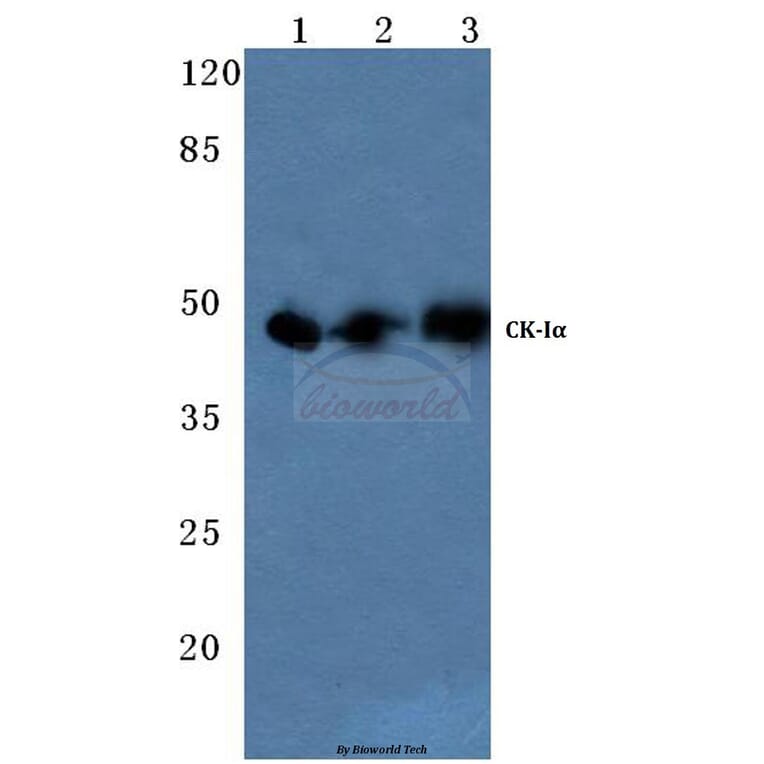 Anti-Casein Kinase Iα (Q317) Antibody from Bioworld Technology (BS1849) - Antibodies.com