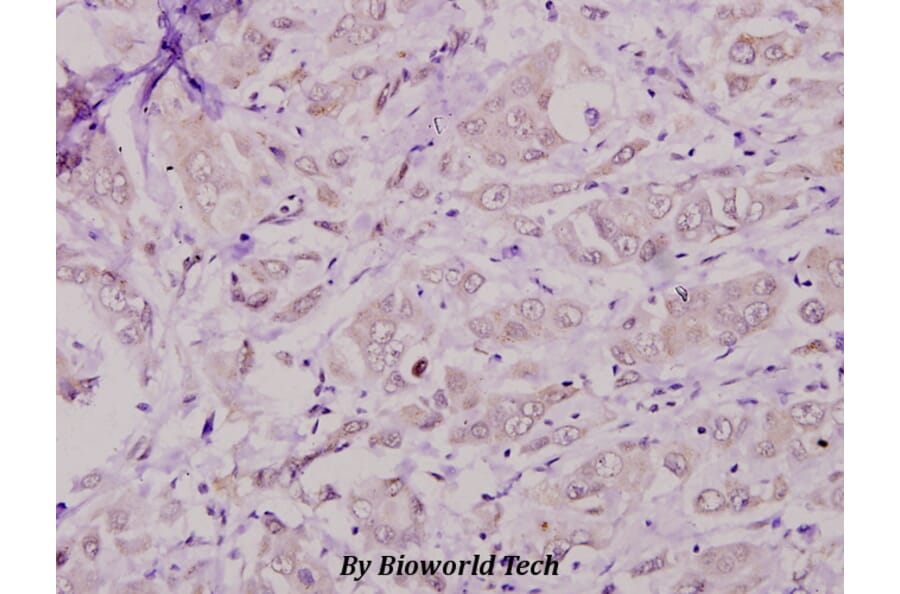 Anti-Casein Kinase Iα (Q317) Antibody from Bioworld Technology (BS1849) - Antibodies.com