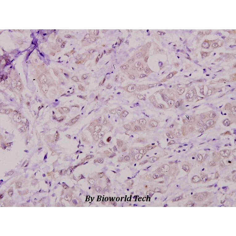 Anti-Casein Kinase Iα (Q317) Antibody from Bioworld Technology (BS1849) - Antibodies.com