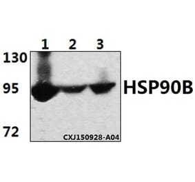Anti-HSP90B (E222) Antibody from Bioworld Technology (BS1851) - Antibodies.com