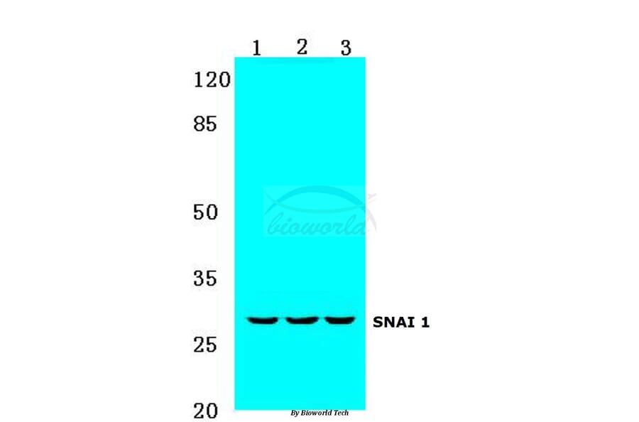 Anti-SNAI 1 (A242) Antibody from Bioworld Technology (BS1853) - Antibodies.com