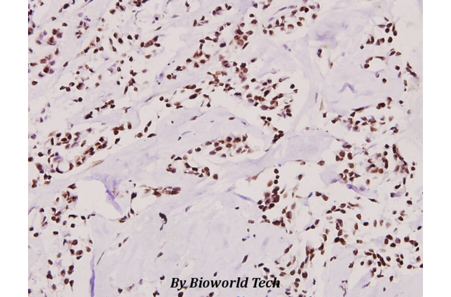 Anti-SNAI 1 (A242) Antibody from Bioworld Technology (BS1853) - Antibodies.com