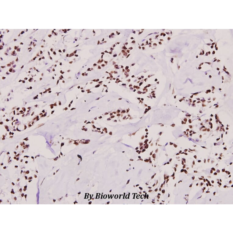 Anti-SNAI 1 (A242) Antibody from Bioworld Technology (BS1853) - Antibodies.com