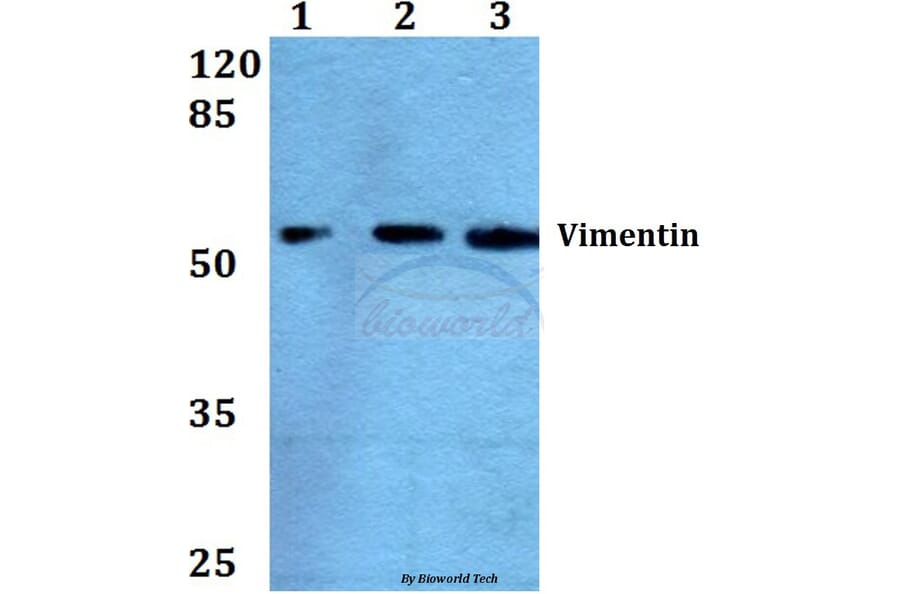 Anti-Vimentin (L79) Antibody from Bioworld Technology (BS1855) - Antibodies.com