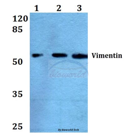 Anti-Vimentin (L79) Antibody from Bioworld Technology (BS1855) - Antibodies.com