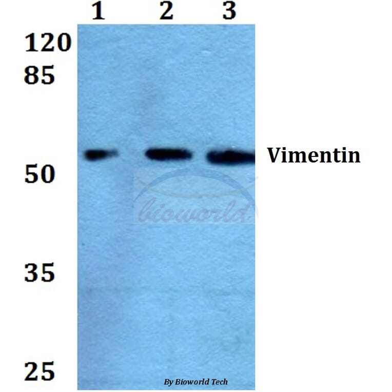 Anti-Vimentin (L79) Antibody from Bioworld Technology (BS1855) - Antibodies.com