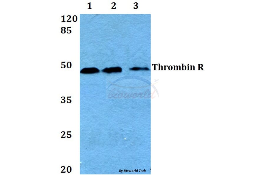 Anti-Thrombin R (G17) Antibody from Bioworld Technology (BS1856) - Antibodies.com