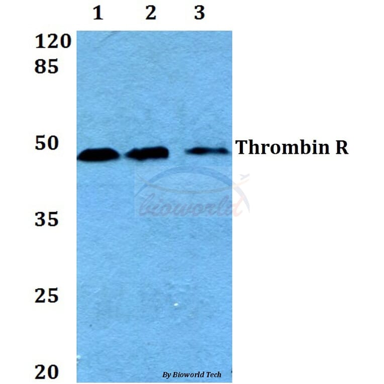 Anti-Thrombin R (G17) Antibody from Bioworld Technology (BS1856) - Antibodies.com