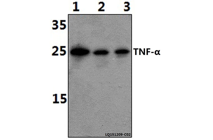 Anti-TNF-α (Q178) Antibody from Bioworld Technology (BS1857) - Antibodies.com