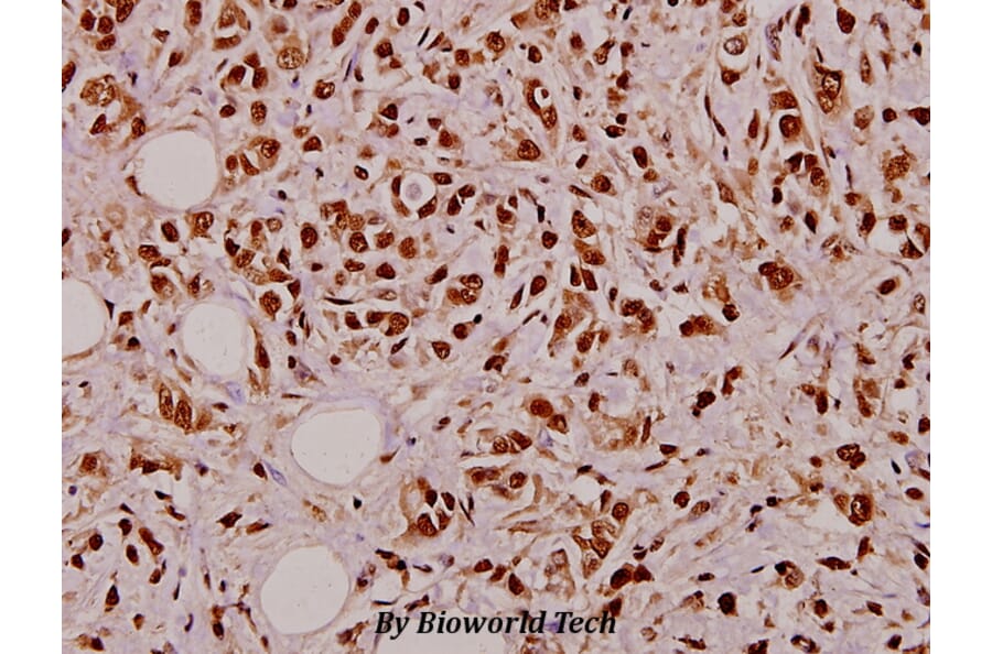 Anti-TNF-α (Q178) Antibody from Bioworld Technology (BS1857) - Antibodies.com