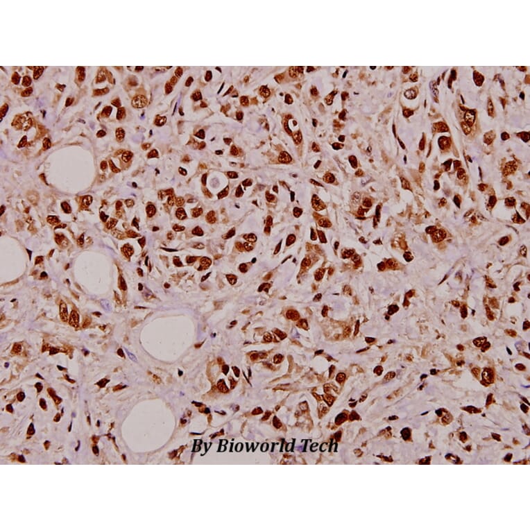 Anti-TNF-α (Q178) Antibody from Bioworld Technology (BS1857) - Antibodies.com