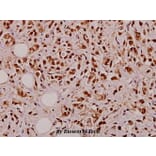 Anti-TNF-α (Q178) Antibody from Bioworld Technology (BS1857) - Antibodies.com
