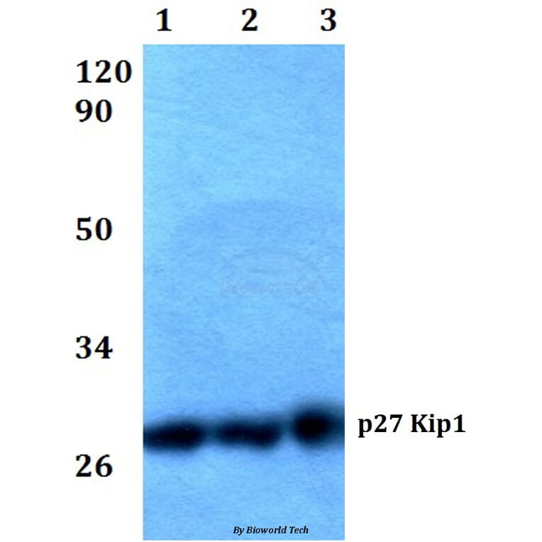 Anti-p27 Kip1 (P191) Antibody from Bioworld Technology (BS1858) - Antibodies.com