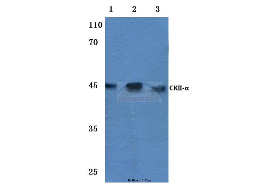 Anti-Casein Kinase IIα (T251) Antibody from Bioworld Technology (BS1859) - Antibodies.com