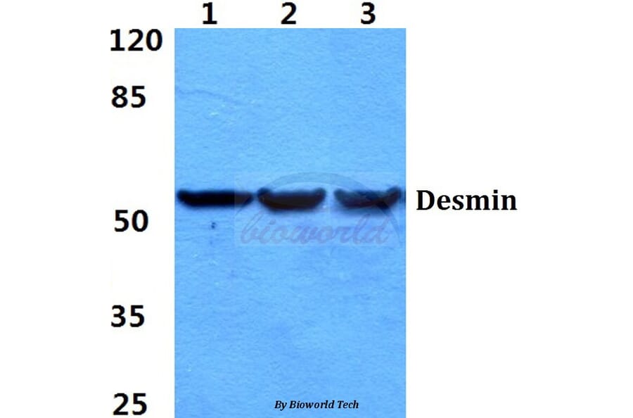 Anti-Desmin (V56) Antibody from Bioworld Technology (BS1860) - Antibodies.com