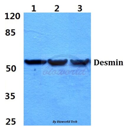 Anti-Desmin (V56) Antibody from Bioworld Technology (BS1860) - Antibodies.com
