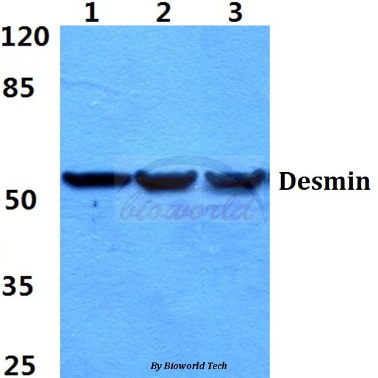 Anti-Desmin (V56) Antibody from Bioworld Technology (BS1860) - Antibodies.com