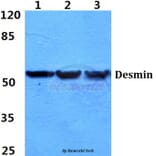 Anti-Desmin (V56) Antibody from Bioworld Technology (BS1860) - Antibodies.com