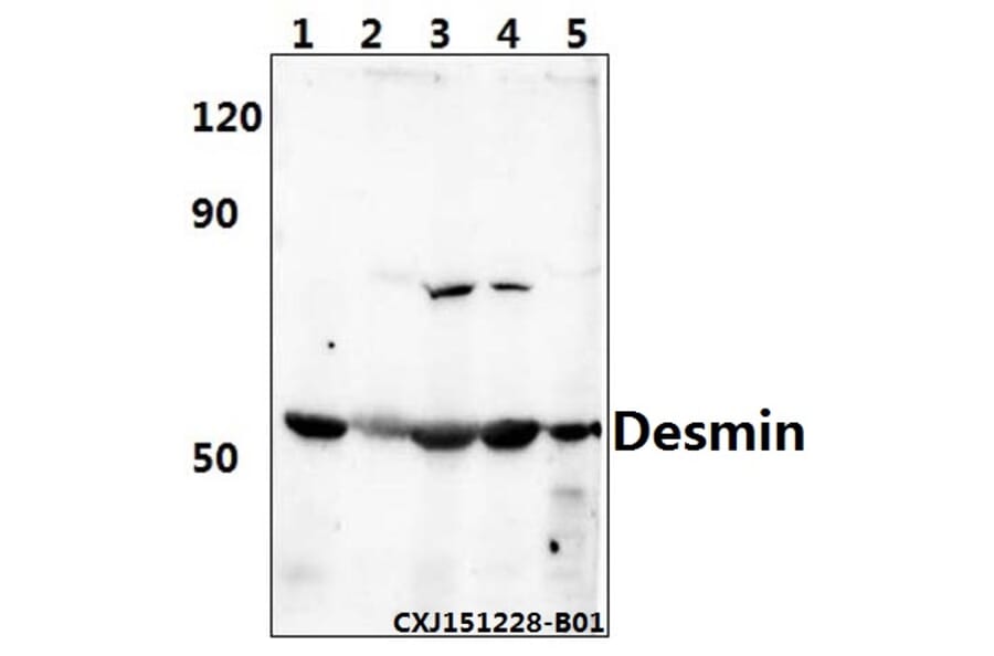 Anti-Desmin (V56) Antibody from Bioworld Technology (BS1860) - Antibodies.com
