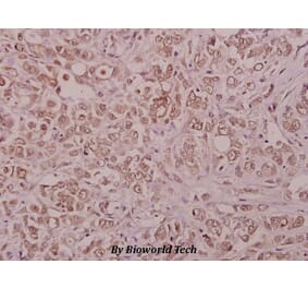 Anti-PIG11 (P93) Antibody from Bioworld Technology (BS1865) - Antibodies.com