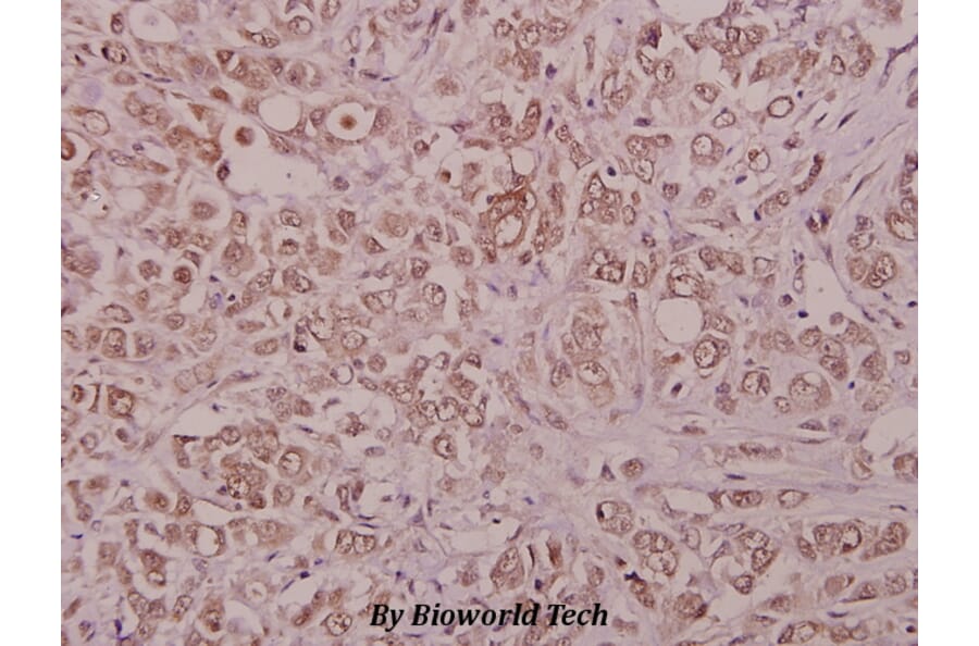 Anti-PIG11 (P93) Antibody from Bioworld Technology (BS1865) - Antibodies.com