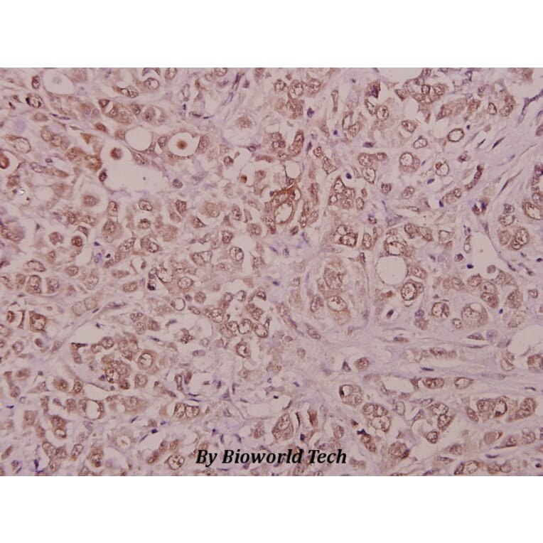 Anti-PIG11 (P93) Antibody from Bioworld Technology (BS1865) - Antibodies.com