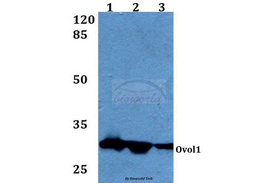Anti-Ovol1 (K16) Antibody from Bioworld Technology (BS1866) - Antibodies.com