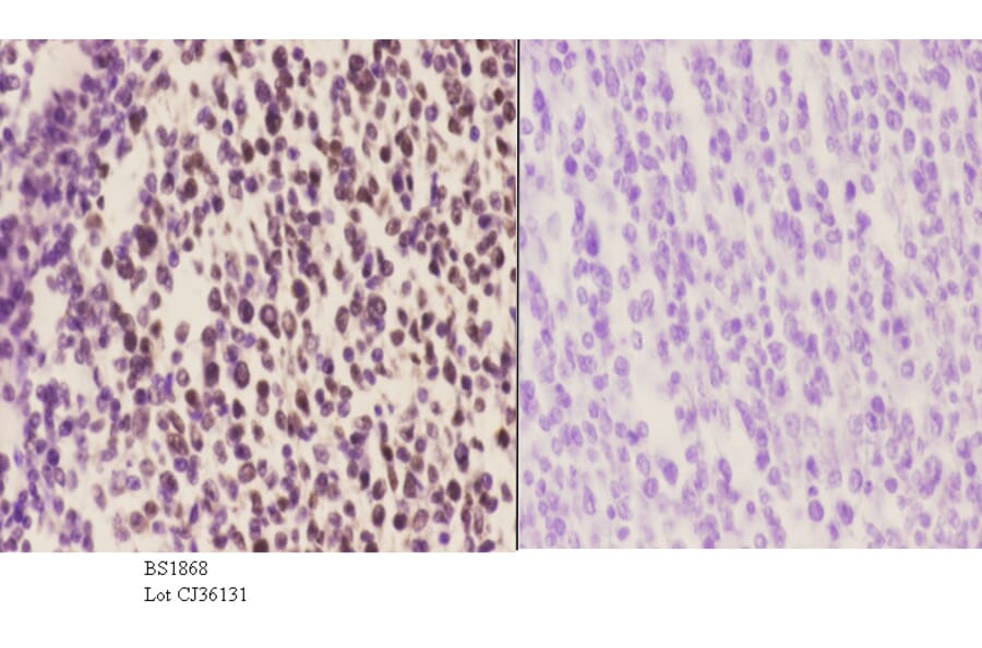Anti-BACH1 (L160) Antibody from Bioworld Technology (BS1868) - Antibodies.com