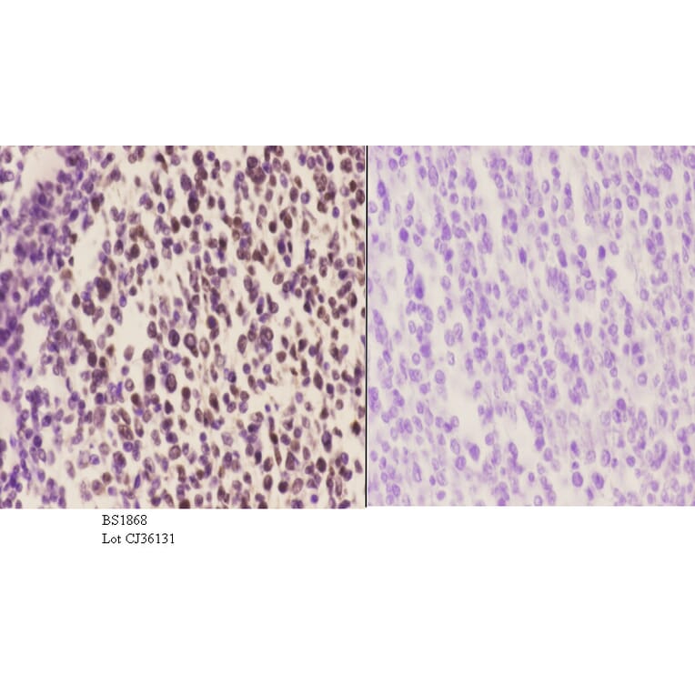 Anti-BACH1 (L160) Antibody from Bioworld Technology (BS1868) - Antibodies.com