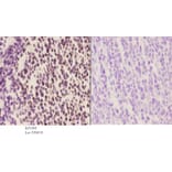 Anti-BACH1 (L160) Antibody from Bioworld Technology (BS1868) - Antibodies.com