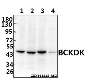 Anti-BCKDK (E41) Antibody from Bioworld Technology (BS1869) - Antibodies.com
