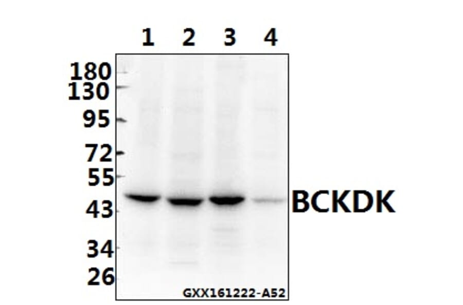 Anti-BCKDK (E41) Antibody from Bioworld Technology (BS1869) - Antibodies.com
