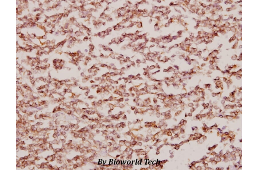 Anti-BCKDK (E41) Antibody from Bioworld Technology (BS1869) - Antibodies.com